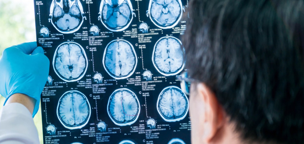 แพทย์กำลังวินิจฉัยภาพถ่ายที่ได้จากการอุโมงค์ MRI